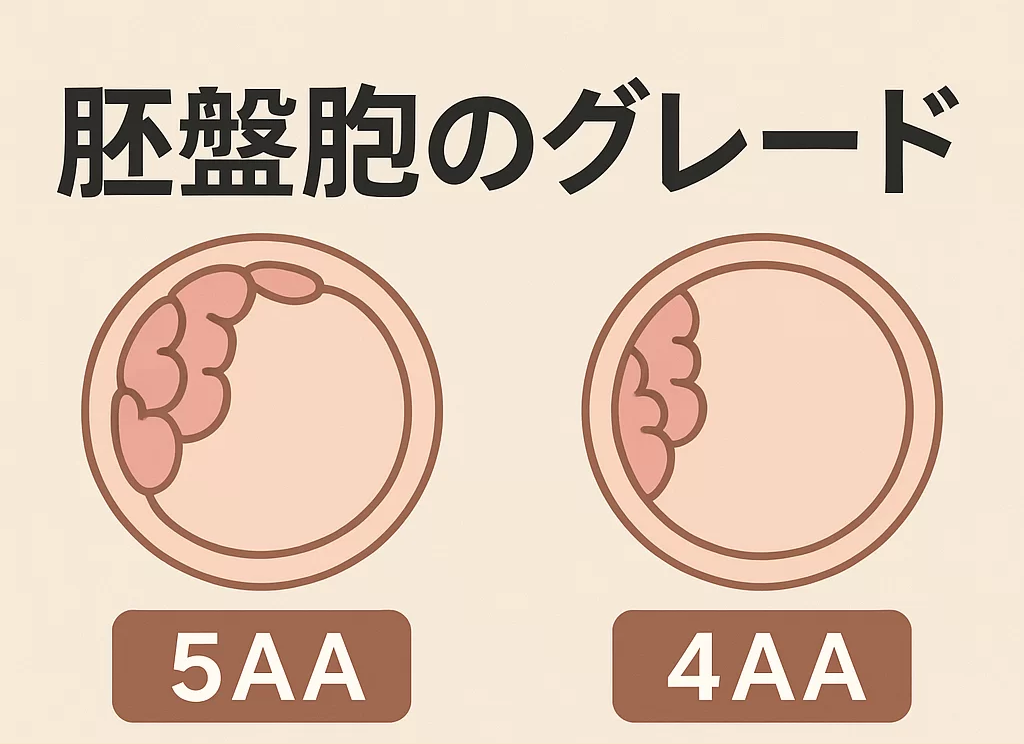 胚盤胞のグレード(5aaと 4aa 妊娠率は?)