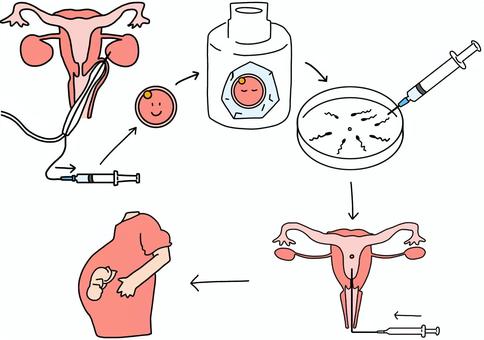 妊活で注目!【シリンジ法のデメリット】とは?空気に触れると?! | 大阪府豊中市の不妊鍼灸なら、ぽん鍼灸院