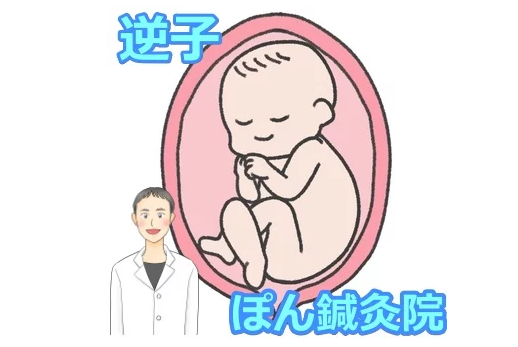 逆子と分かればすぐに鍼灸(お灸)を!