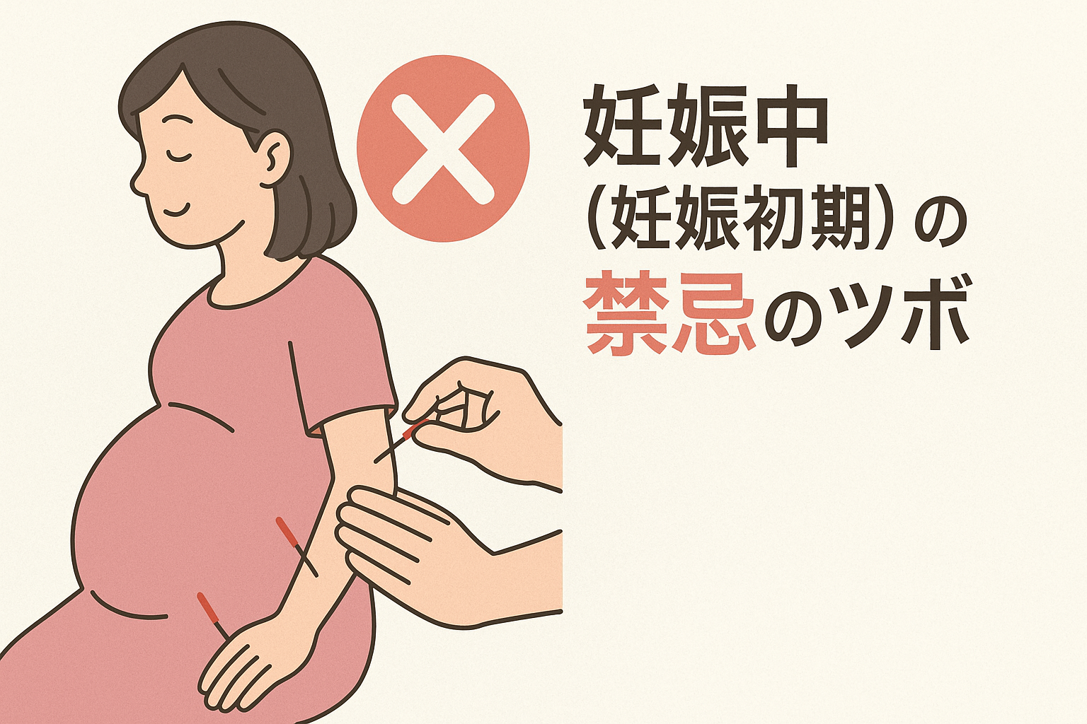 妊娠中(妊娠初期)の鍼灸【禁忌のツボ】を押してしまった!?